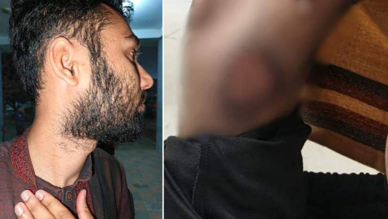 হামলার শিকার মোহাম্মদ ইয়াসিন আরাফাত