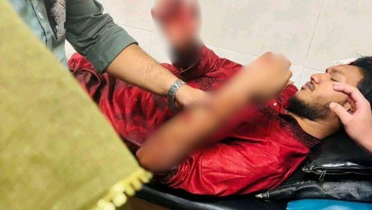 নামাজঘরের পাশে মাদক-জুয়া, প্রতিবাদ করায় কৃষকদল নেতার হামলায় বিশ্ববিদ্যালয় ছাত্র রক্তাক্ত