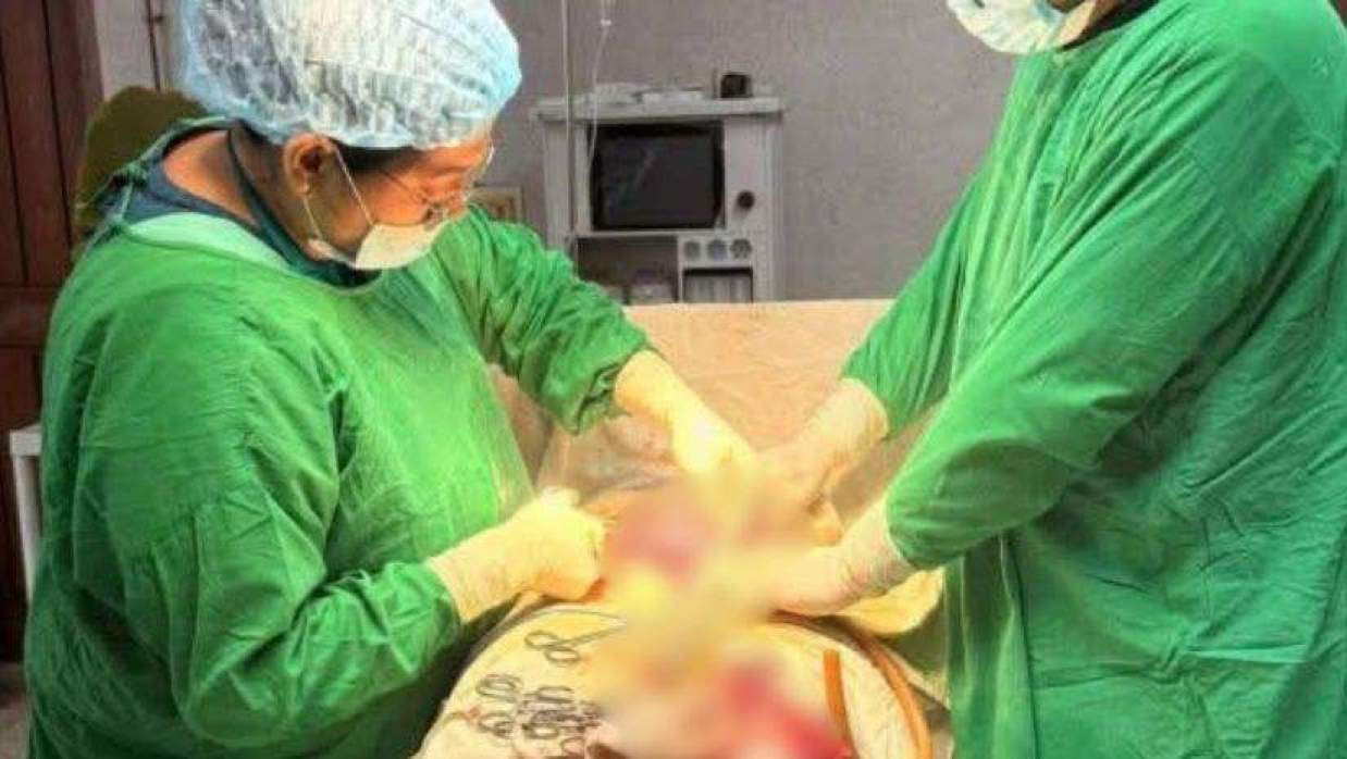 কেন্দুয়া উপজেলা স্বাস্থ্য কমপ্লেক্সে ৫ বছরে বিনামূল্যে ১০৭ প্রসূতির সফল সিজার