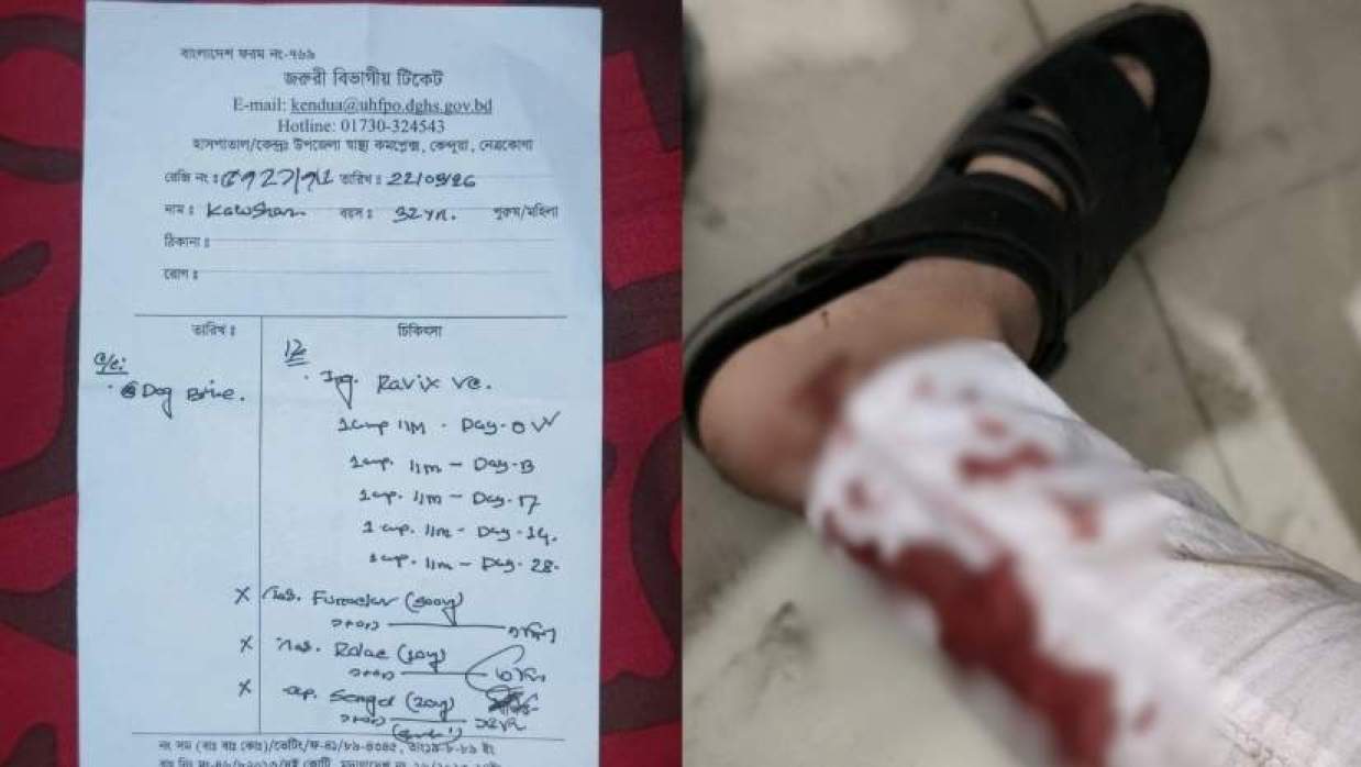 কেন্দুয়ায় একদিনেই কুকুরের কামড়ে আহত ২০ জনের বেশি