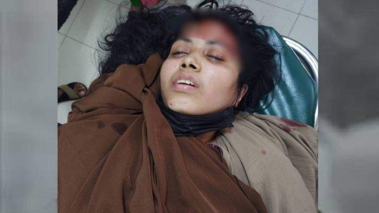 মোটরসাইকেলের ধাক্কায় গুরুতর আহত চবি শিক্ষার্থী