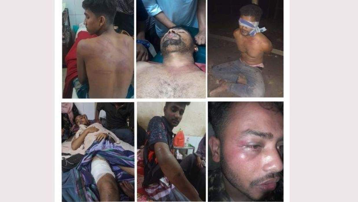 ভুক্তভোগী ছাত্রদল নেতাকর্মীরা