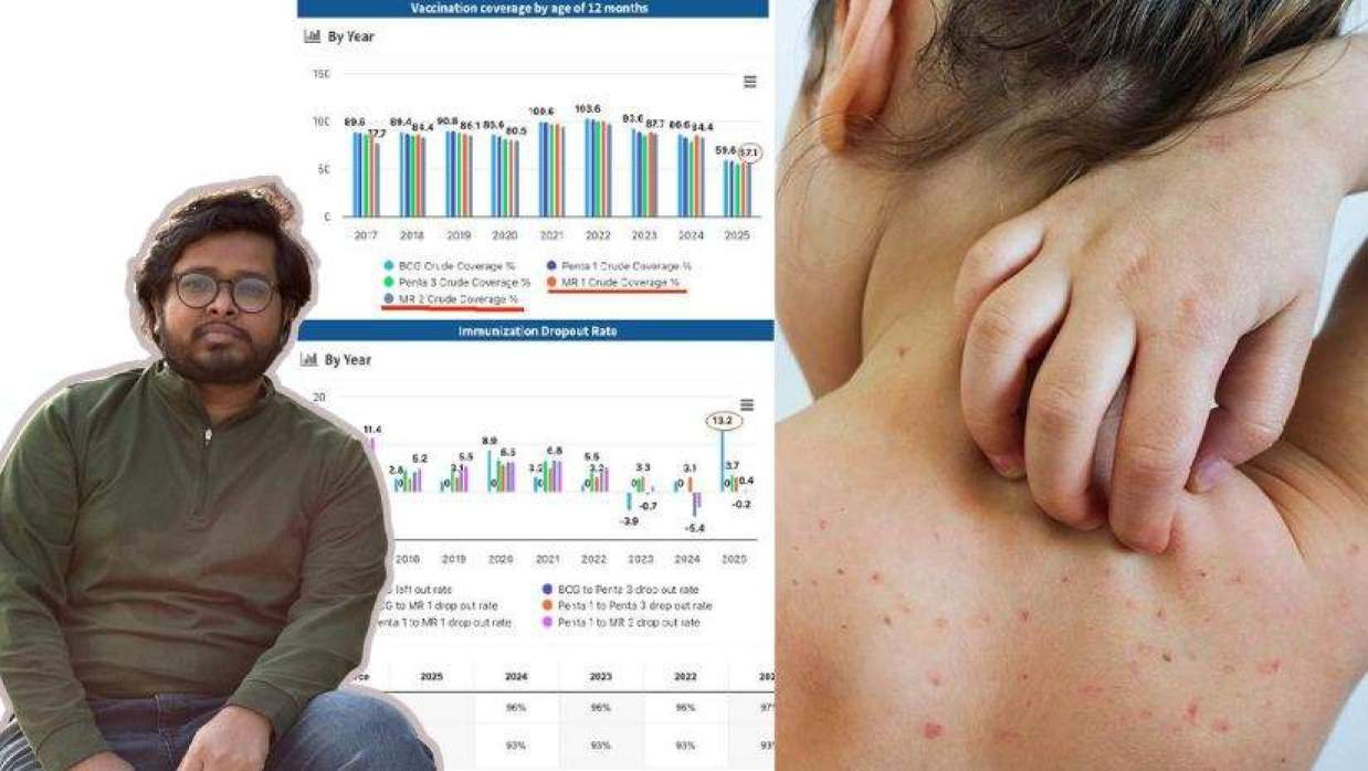 হাম নিয়ে দোষ চাপানোয় ব্যস্ত রাজনীতিবিদরা, অপতথ্য মন্ত্রীর মুখ দিয়ে কে বের করাল?