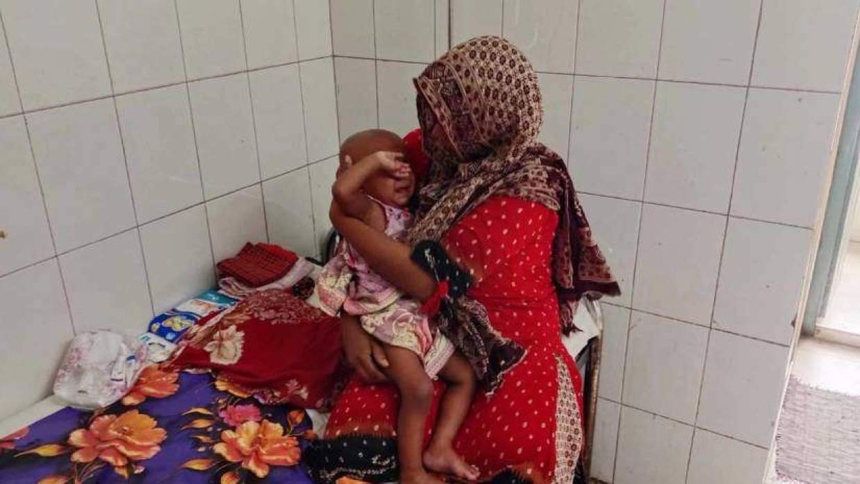 যশোরে হামের প্রাদুর্ভাবের শঙ্কায় স্বাস্থ্য বিভাগের সতর্কতা