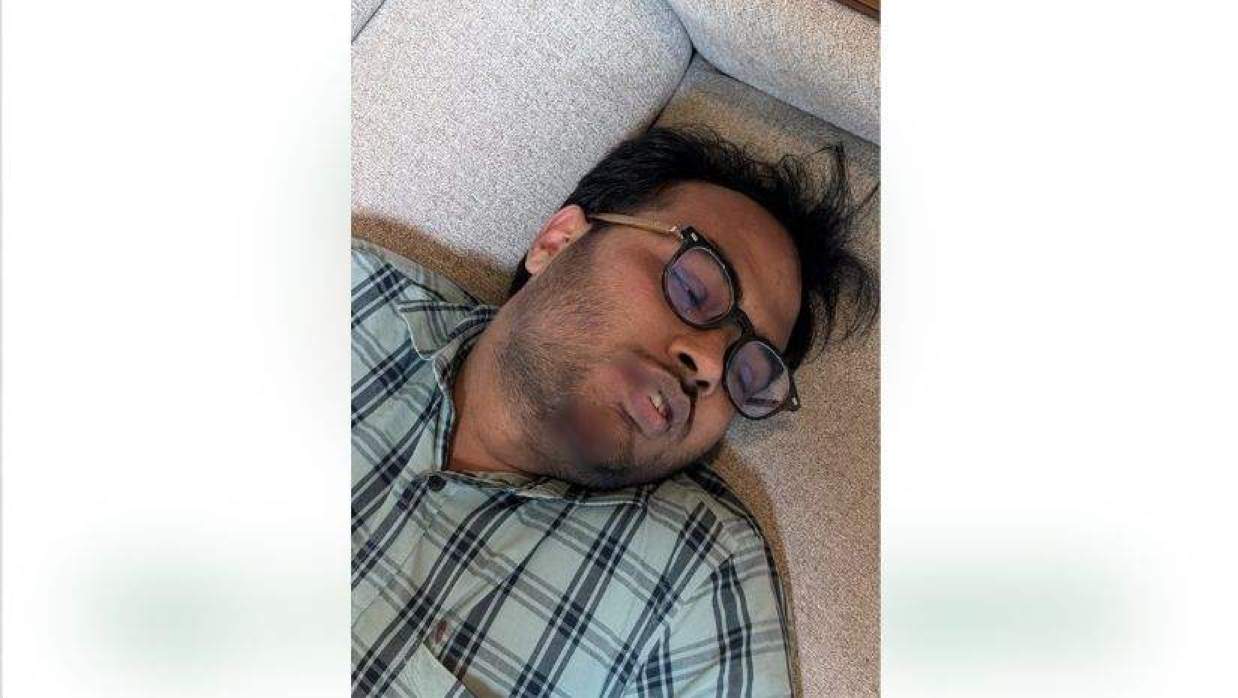 আহতদের মধ্যে গুরুতর দুজনকে হাসপাতালে নেওয়া হয়েছে