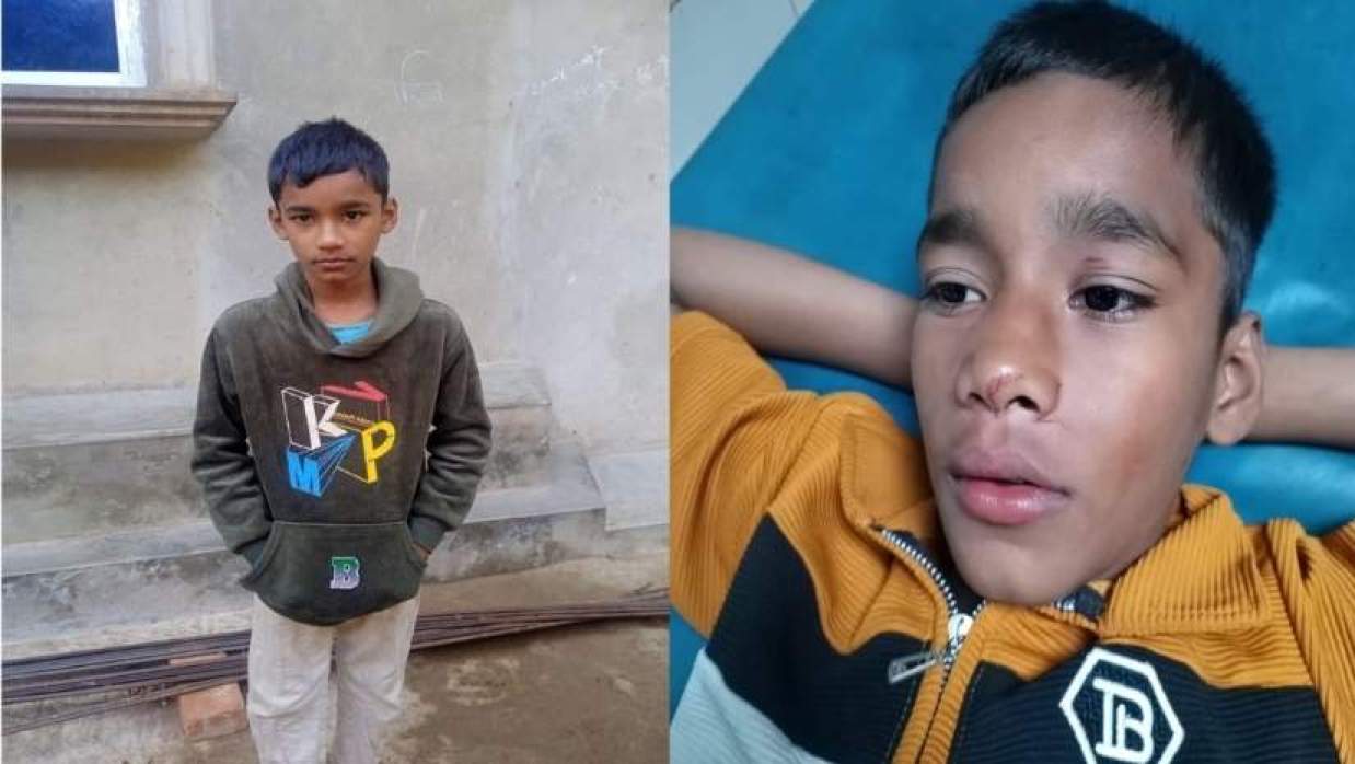 মাদ্রাসা ছাত্র আহত হয়ে হাসপাতালে ভর্তি