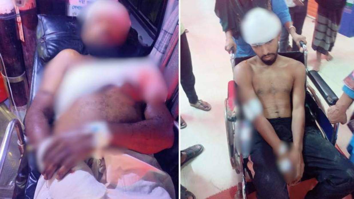 সাতকানিয়ায় বিএনপির দুই পক্ষের সংঘর্ষে আহত ৫