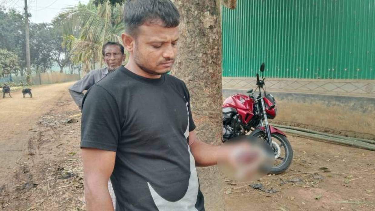 খামারে রাতের আঁধারে ষাঁড়ের জিহ্বা কেটে দিল দুর্বৃত্তরা