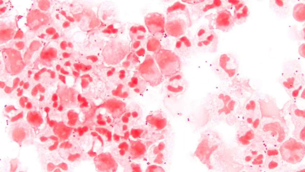 ব্যাকটেরিয়া জোড়া  Neisseria meningitidis এর মাইক্রোস্কোপিক ছবি