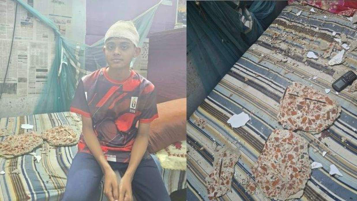 ঢাকা কলেজে মাথায় খসে পড়ল পলেস্তারা, গুরুতর আহত শিক্ষার্থী