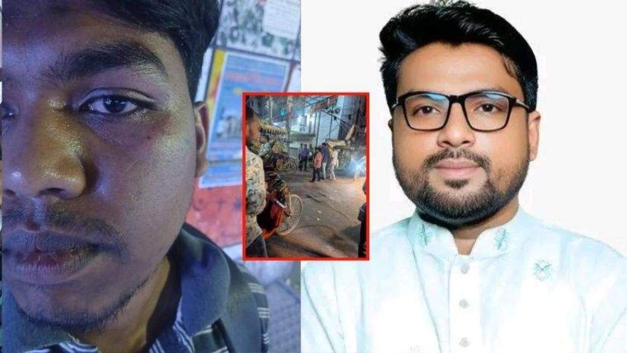 ‘ঢাকা বিশ্ববিদ্যালয় ছাত্র পরিচয় দিলে আরও বেশি মারধর করেন ছাত্রদল নেতা’