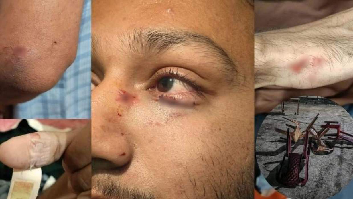 রুয়েটে শিক্ষার্থীদের দুই গ্রুপের সংঘর্ষ 