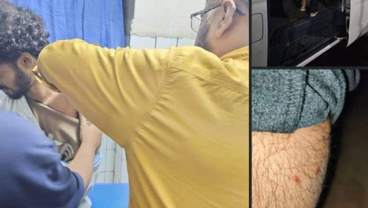 যবিপ্রবিতে কুকুরের কামড়ে আহত শিক্ষার্থী, আতঙ্কে শিক্ষক-শিক্ষার্থীরা