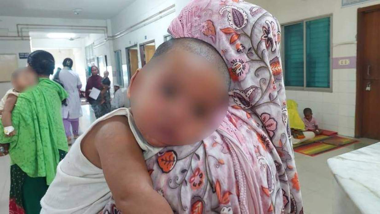 হামের লক্ষণ নিয়ে ময়মনসিংহ মেডিকেলে আরও ২৭ শিশু ভর্তি