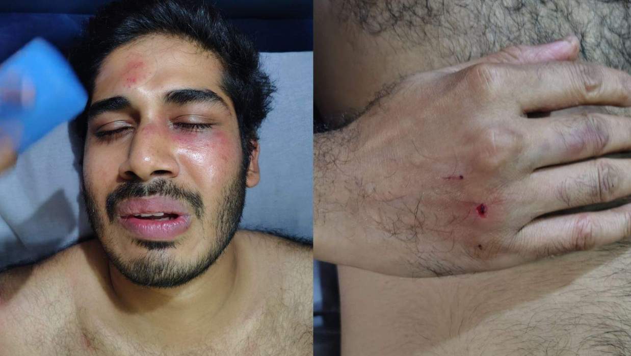 হাসপাতালে চিকিৎসাধীন অবস্থায় আহত শিক্ষার্থী মেহেদী হাসান