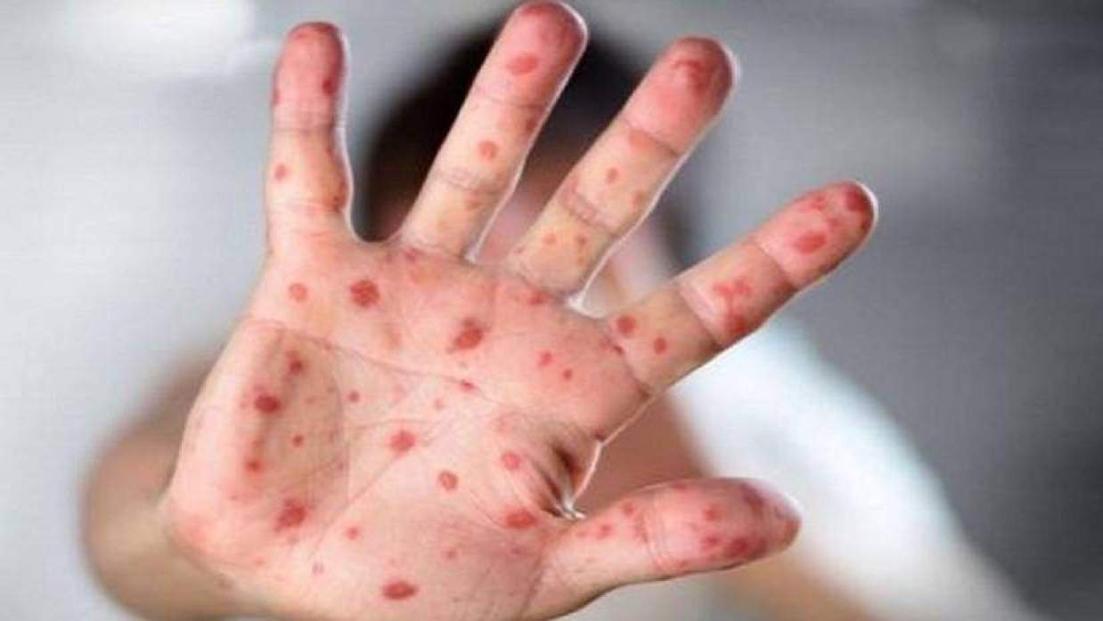 প্রতীকী ছবি