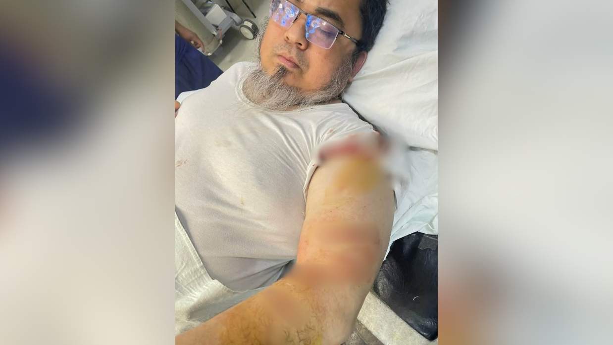 ক্যান্সার হাসপাতালের উপ-পরিচালককে কুপিয়ে জখম