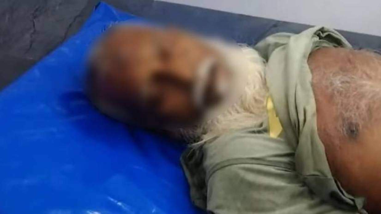 সংঘর্ঘে নিহত মোহন শেখের মরদেহ