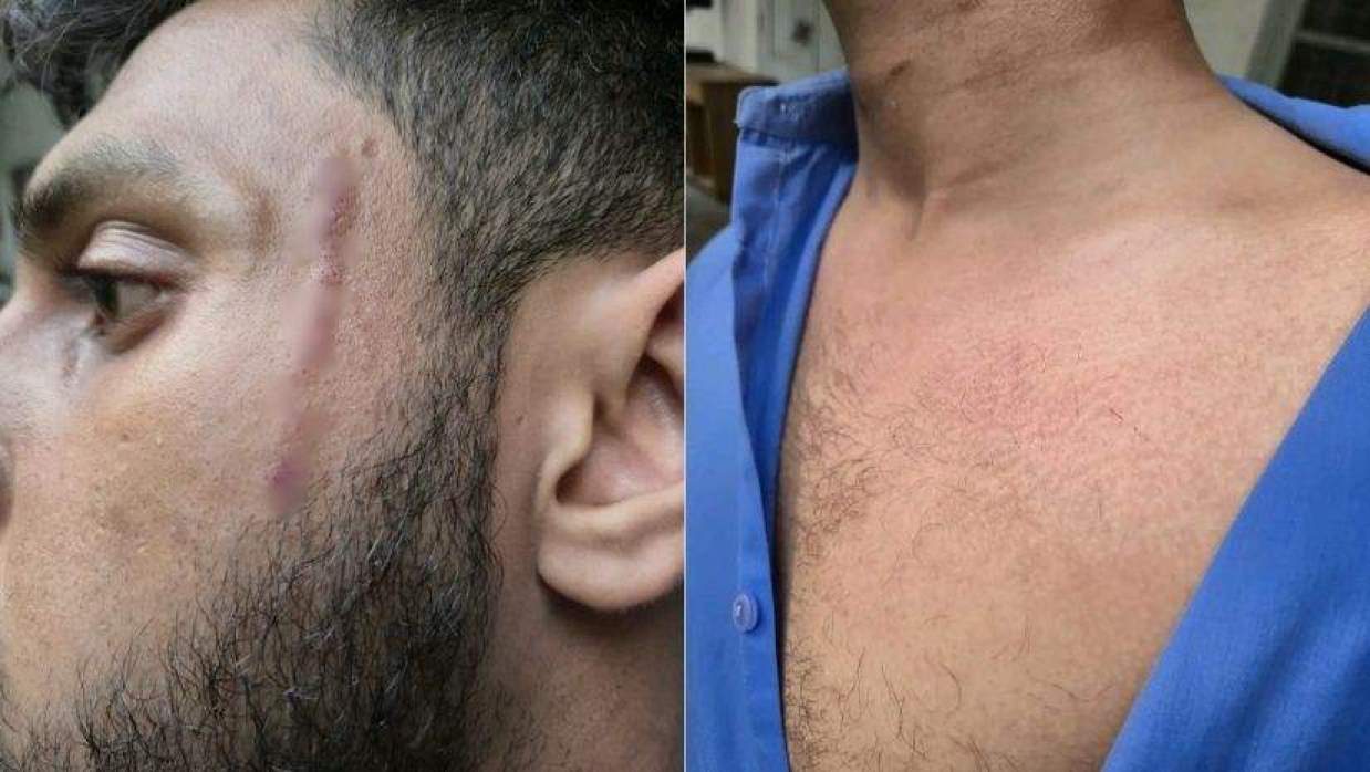 কুমিল্লা পলিটেকনিক ইনস্টিটিউটে সাংবাদিকের উপর ছাত্রদলের হামলার অভিযোগ