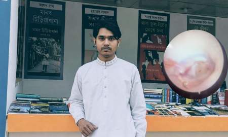 ছাত্রদলের মারধরে ফেটে গেছে ঢাবির হল সংসদ নেতার কানের পর্দা 