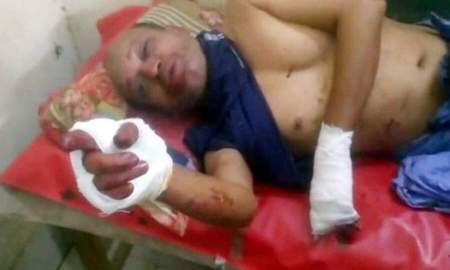 মেয়ে হাত-পা চেপে ধরেন, বুকের ওপর বসে স্ত্রী, ছুরি চালান ছেলে