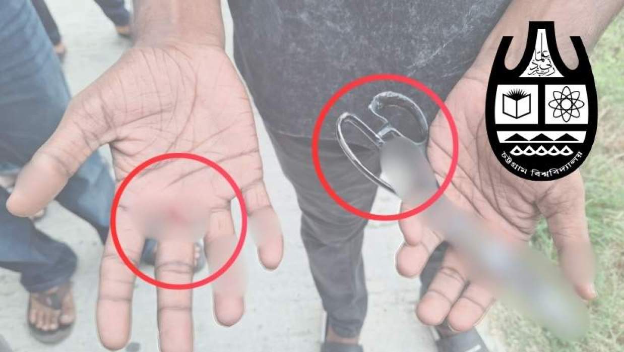 কাঁচি দিয়ে আহত করার অভিযোগ