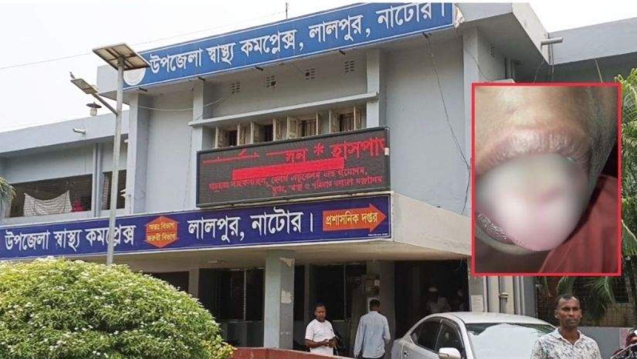 লালপুরে ডাস্টারের আঘাতে  শিশু তাওহীদের জিহবায় গভীর ক্ষত তৈরি হয়েছে
