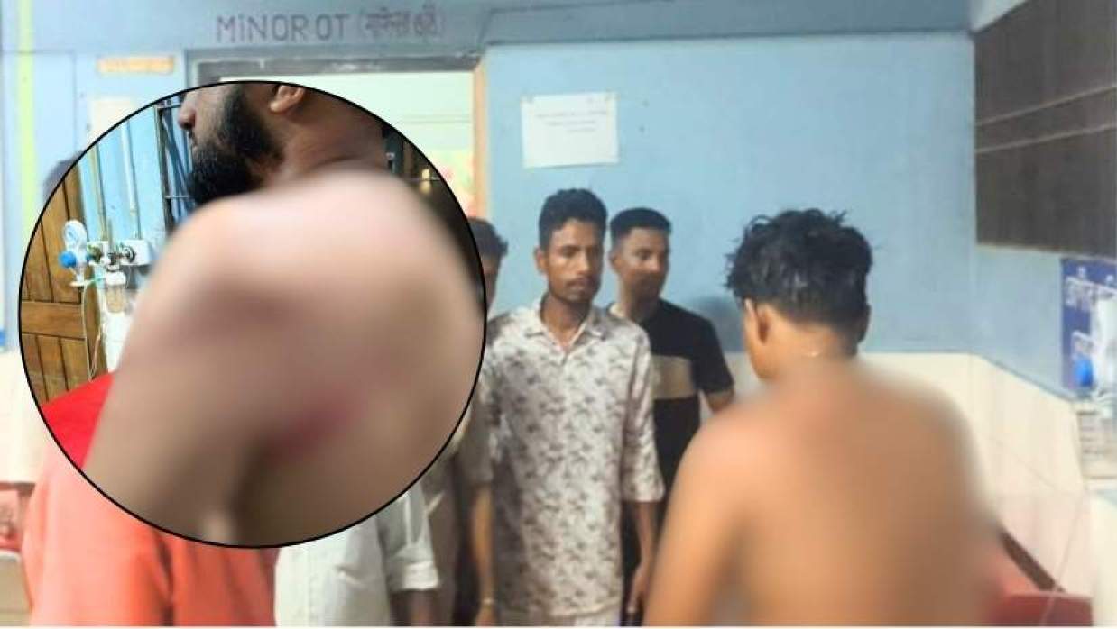 হাসপাতালে চিকিৎসাধীন ছাত্রদল নেতাদের দেখতে যান বিএনপি নেতারা, ইনসেটে আহত জামায়াত নেতা