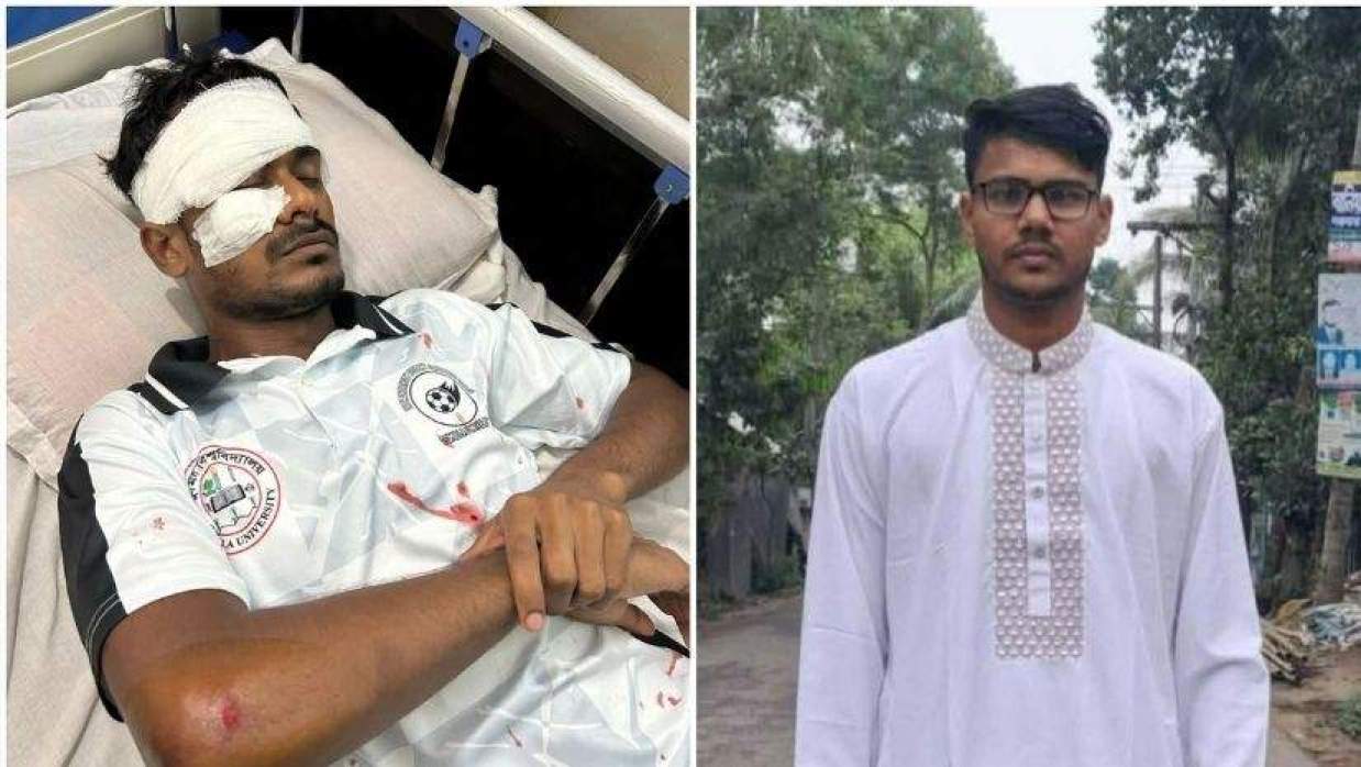 বামে আহত শিক্ষার্থী আকরাম ও ডানে অভিযুক্ত শাহ পরাণ