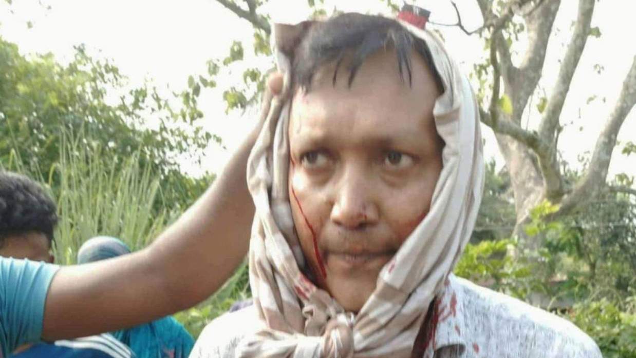 আহত স্কুলশিক্ষক