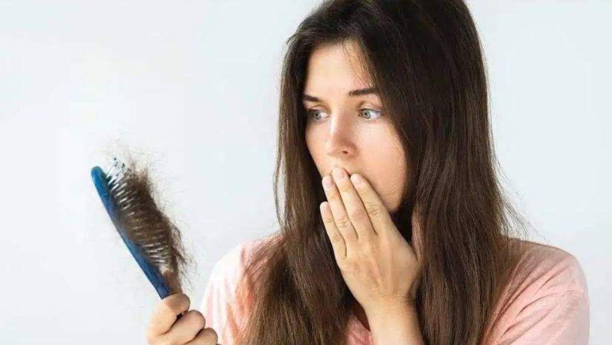 চুল পড়ার পেছনে অনেক ধরনের কারণ থাকতে পারে