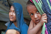 রোহিঙ্গা ক্যাম্পে বাড়ছে হামের প্রাদুর্ভাব