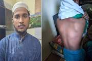 শিক্ষার্থীকে বেধড়ক বেত্রাঘাত, মাদ্রাসা শিক্ষক গ্রেপ্তার