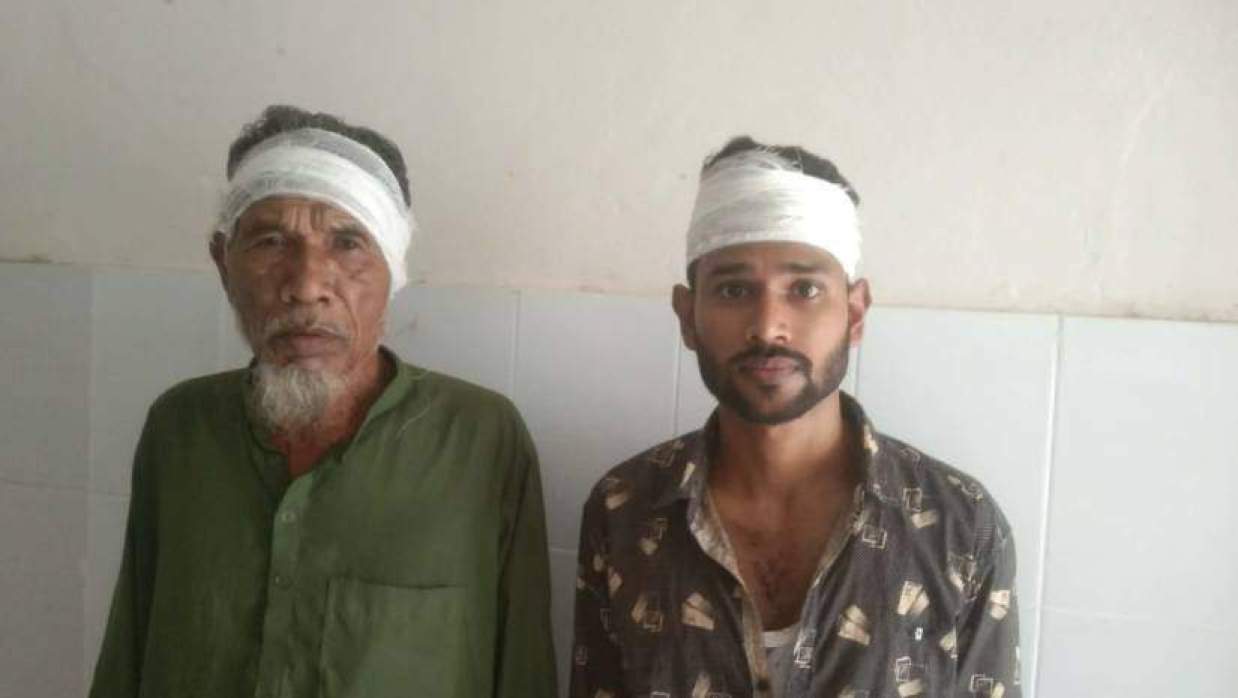 সংঘর্ষে আহত দুজন