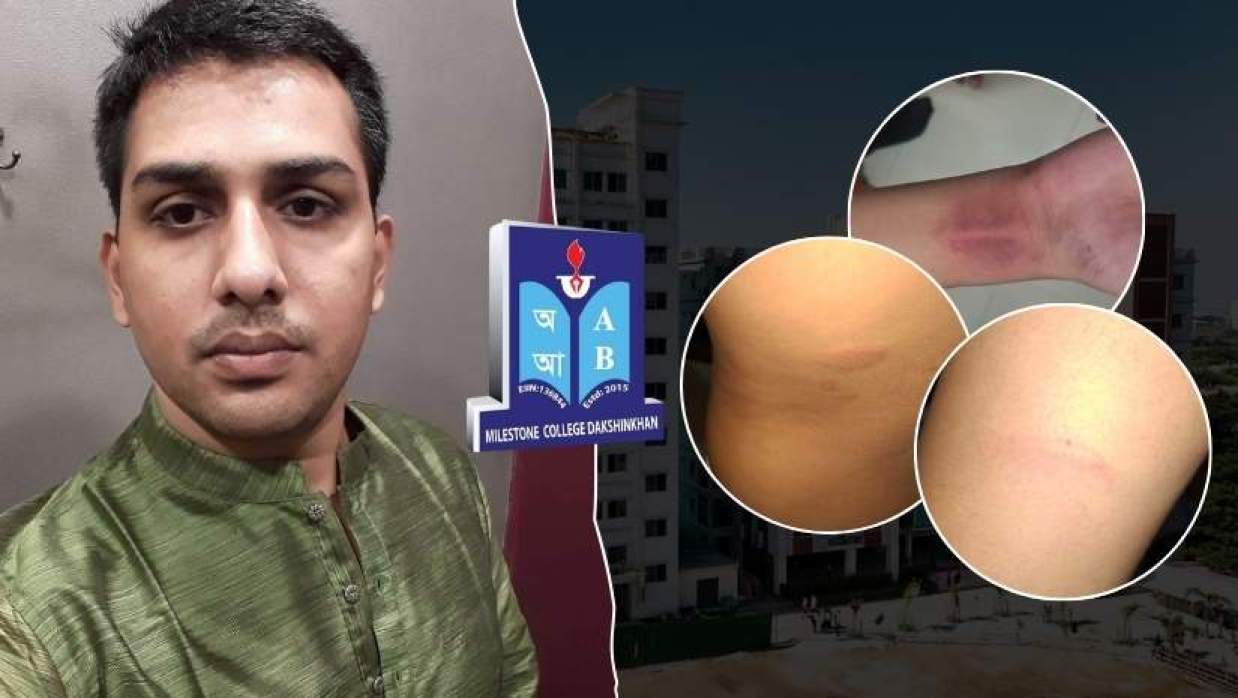 অভিযুক্ত শিক্ষক ও আহত ছাত্রের জখমের ছবি