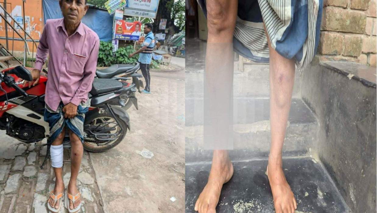 আহত বিপুল কুমার মন্ডল