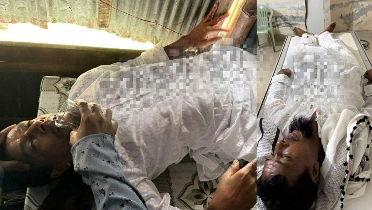 খুলনায় সমাবেশে যাওয়ার পথে হামলার শিকার জামায়াত নেতাকর্মীরা