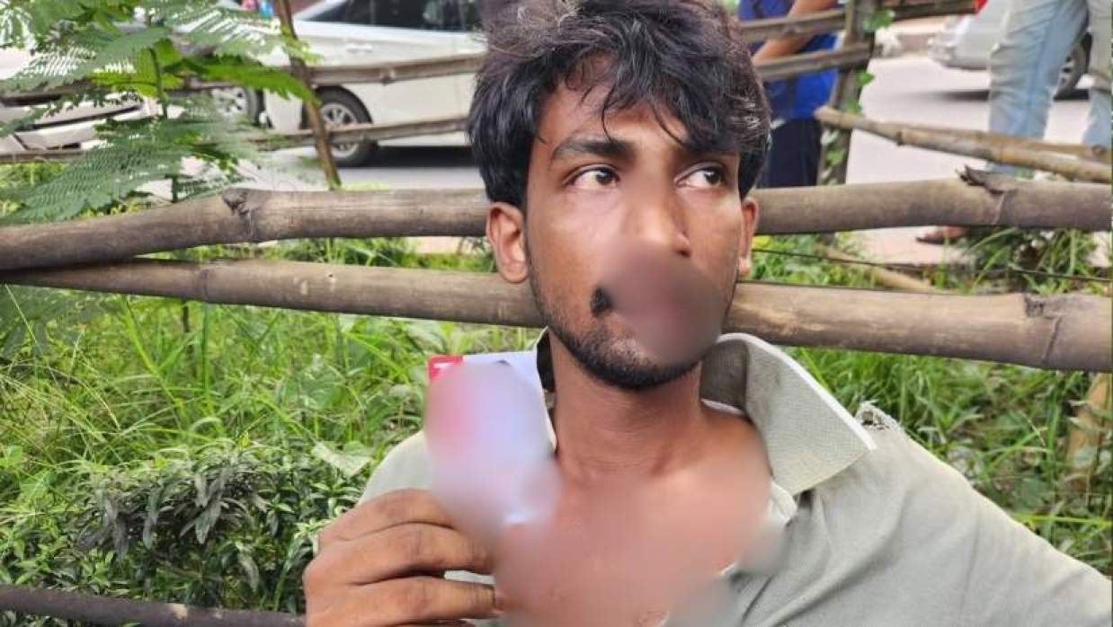 আহত দৈনিক সকালের মাল্টিমিডিয়া রিপোর্টার মাহফুজুর রহমান শিশির