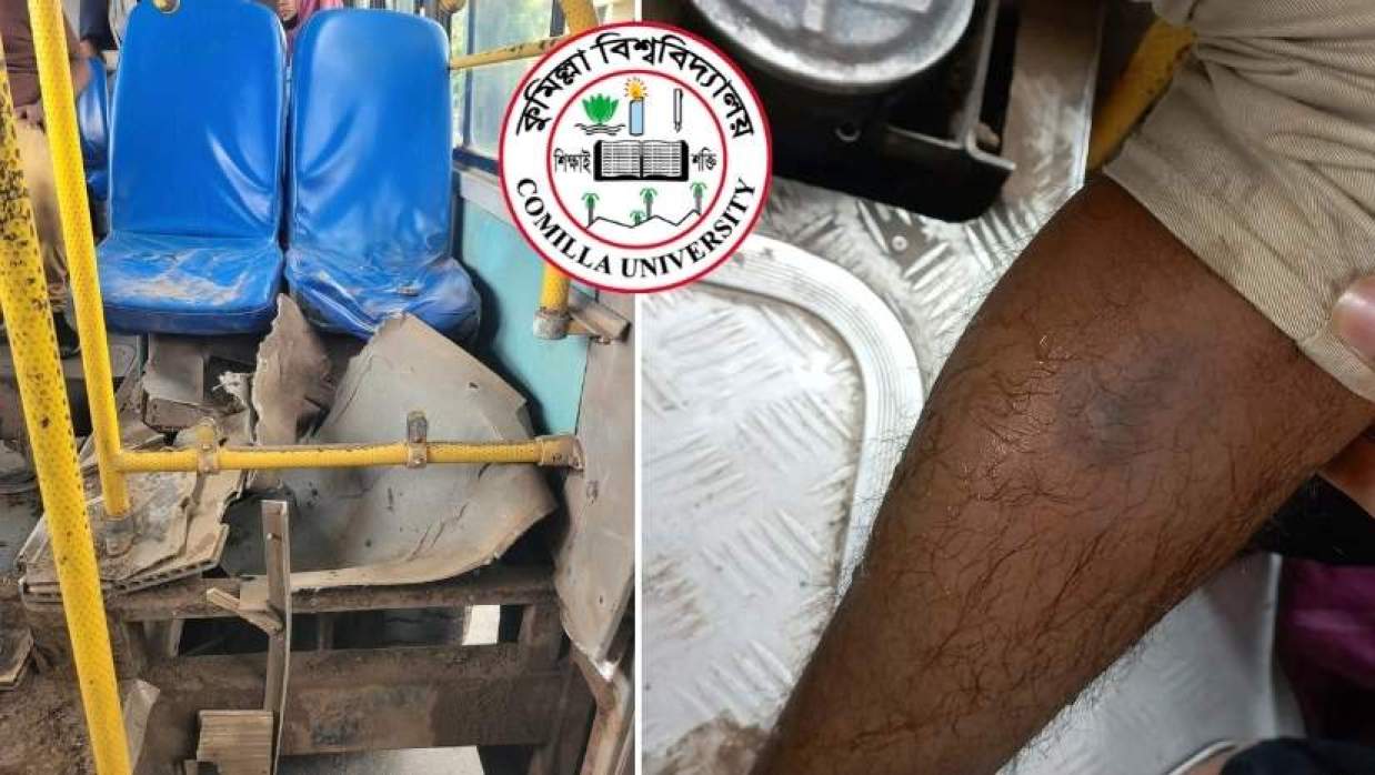 চাকা ব্লাস্ট হওয়া বাস ও আহত শিক্ষার্থীর পা