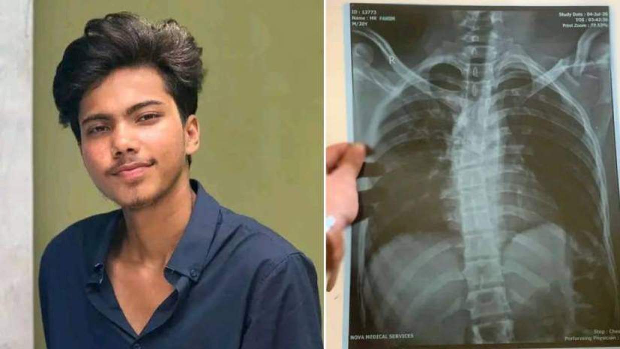 গোলাম রাসুল ফাহিম ও এক্স-রে রিপোর্ট
