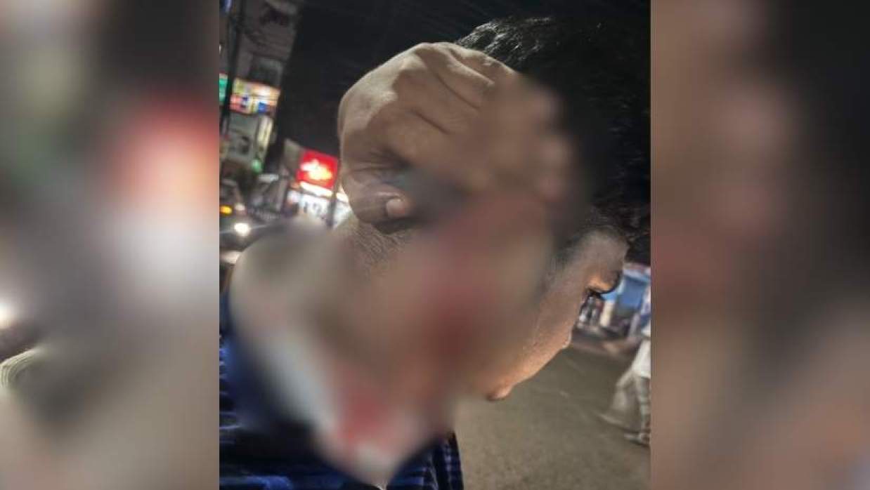 ফুটবল খেলা দেখা নিয়ে শাবিপ্রবি ছাত্রদলের দুই পক্ষের মারামারি, আহত এক