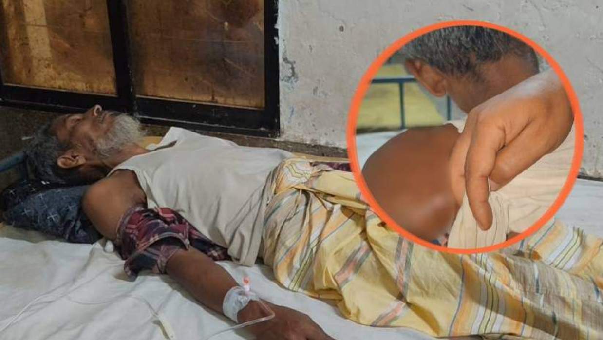হাসপাতালে চিকিৎসাধীন বিপুল প্রামাণিক (ইনসেটে শরীরে আঘাতের চিহ্ন)