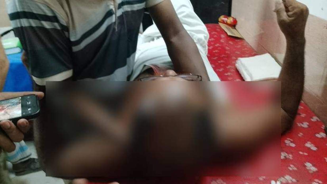 হাসপাতালে চিকিৎসা নিচ্ছেন আহত একজন