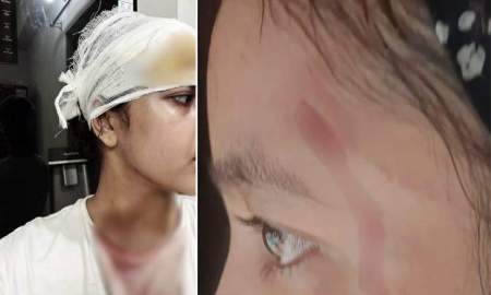পরীক্ষার পড়ায় ব্যাঘাত, শব্দ কমাতে বলতেই জবি ছাত্রীর ওপর হামলা