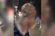 ফুটবল খেলা দেখা নিয়ে শাবিপ্রবি ছাত্রদলের দুই পক্ষের মারামার…