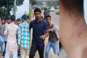 বাসের সিটে বসা নিয়ে শিক্ষার্থীকে মারধরের অভিযোগ ছাত্রদল নেত…
