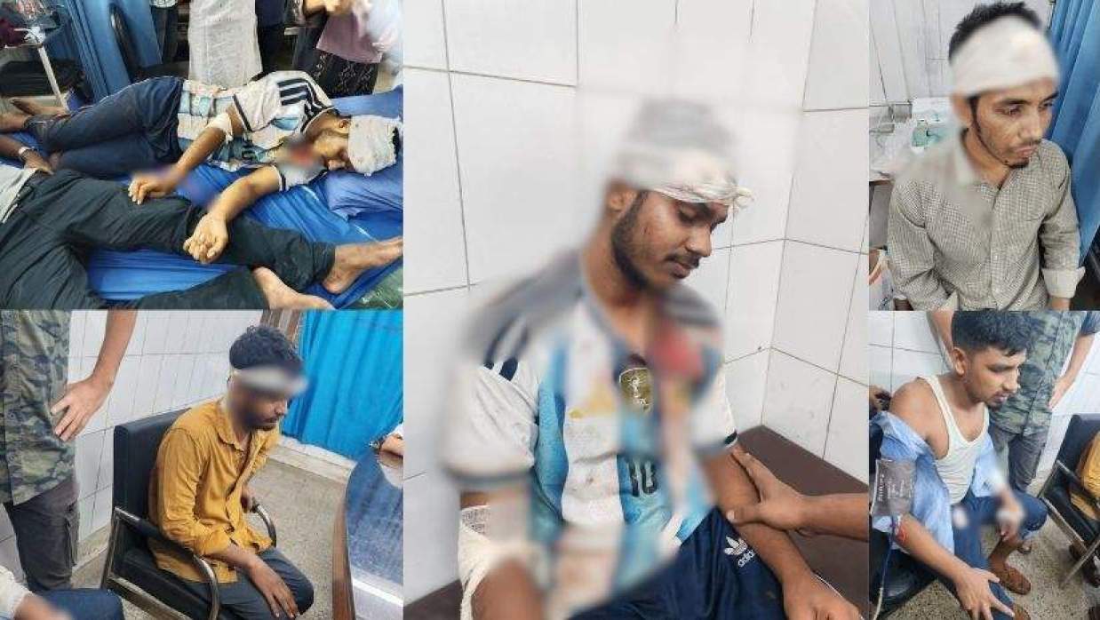 ন্যাশনাল মেডিকেল কলেজ হাসপাতালে হামলায় আহত কয়েক জনের চিকিৎসা চলছে