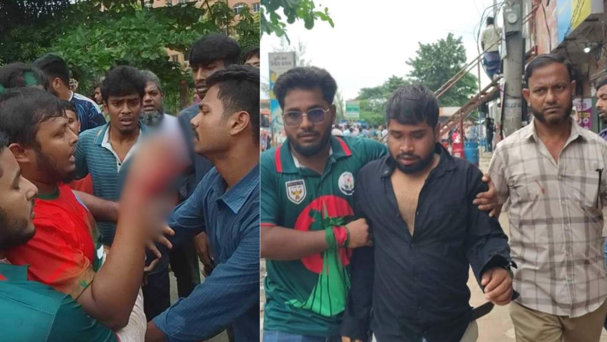 হামলায় আহত শিবির নেতাকর্মীরা 