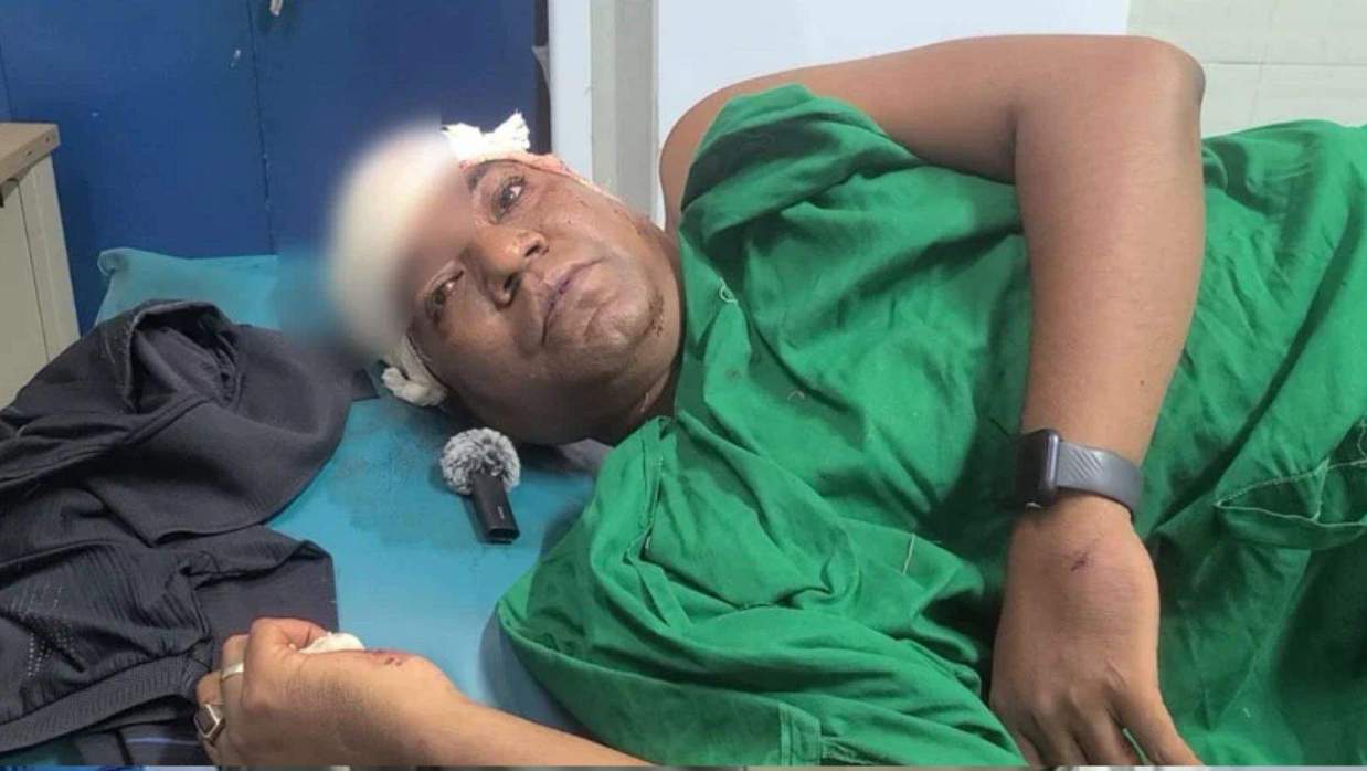 ছাত্রলীগের হামলায় আহত ছাত্রদল নেতা