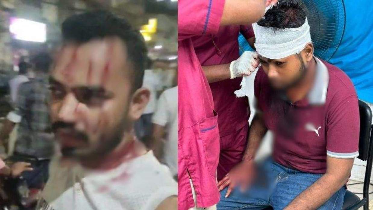  আহত ছাত্রদল নেতাকর্মী